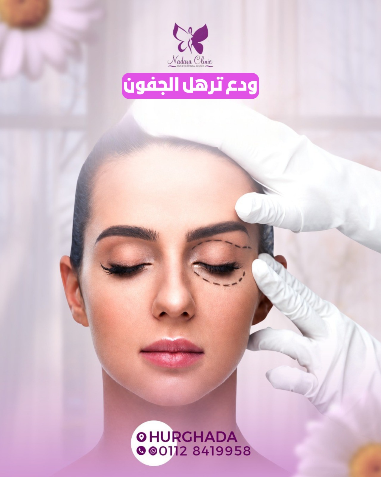 Treatment of sagging eyelids in Hurghada